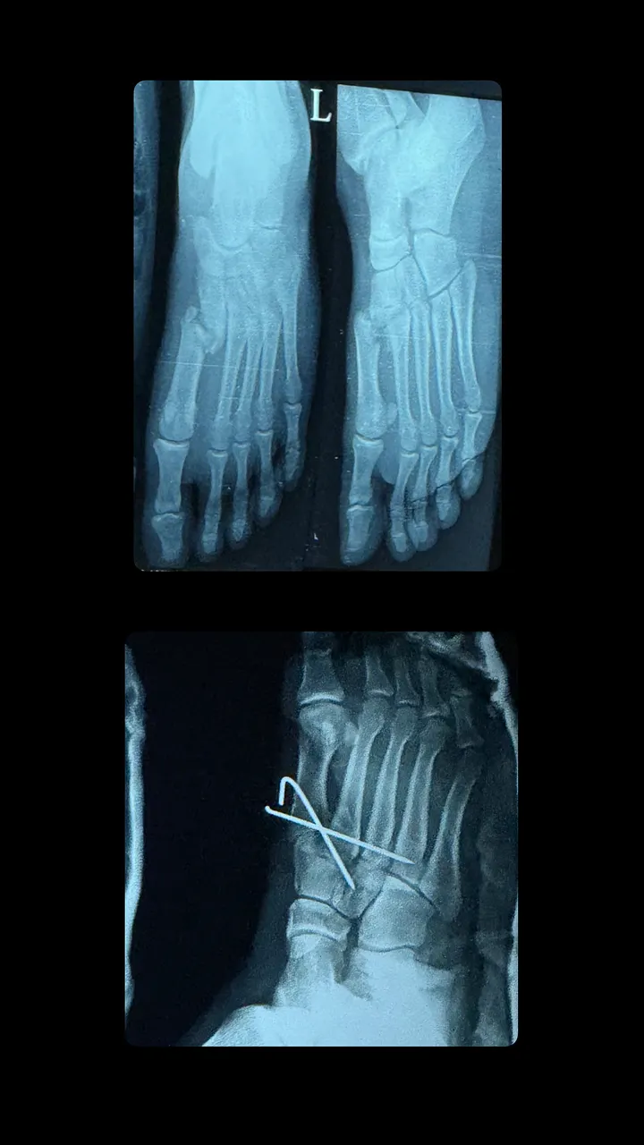 healingSlowly6